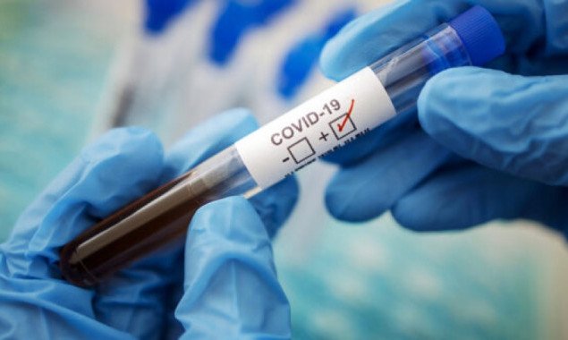 Захворювання на коронавірус виявили в 142 жителів Київщини