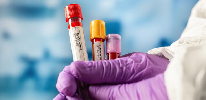 На Київщині за добу виявили 32 нових носії коронавірусу