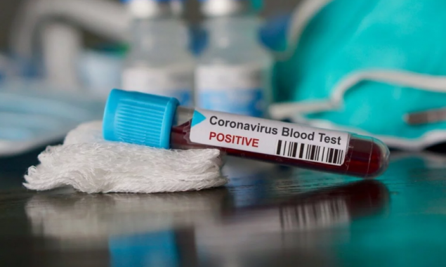 Захворювання на коронавірус виявили в 8 жителів Київщини
