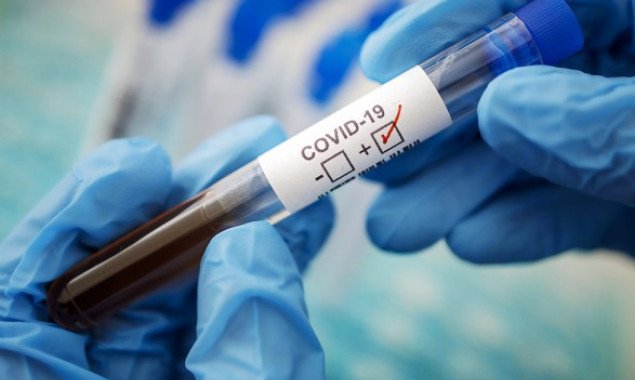 В Киеве за сутки зафиксировано более 140 новых случаев коронавирусной болезни
