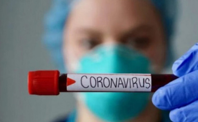 COVID-19 діагностували в 394 жителів Київщини