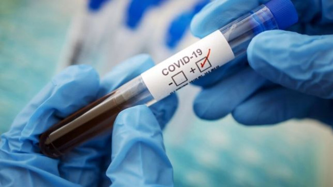 Захворюваність на коронавірус у Бориспільській громаді зросла майже вдвічі за місяць